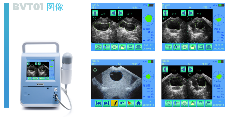 超声膀胱扫描仪的原理介绍和产品特点