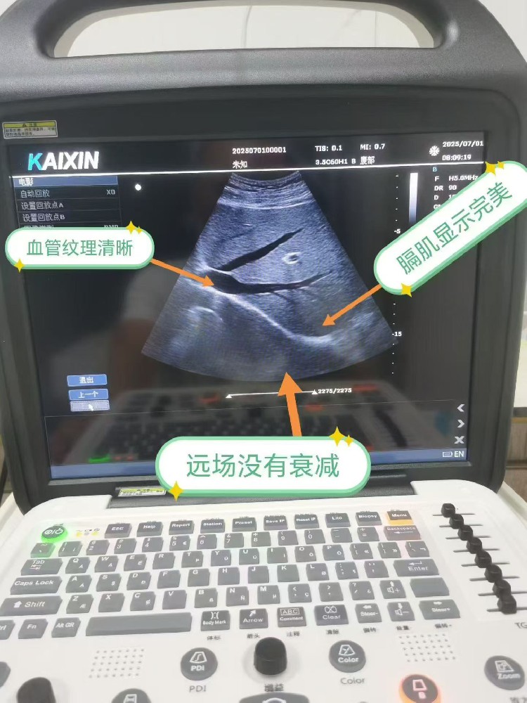 乡镇卫生院基础医疗的优势